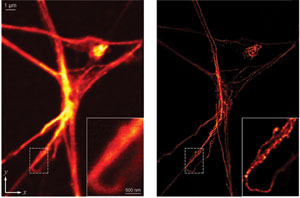 由共聚焦显微镜（左图）和STED（右图）成像的一个神经元。
